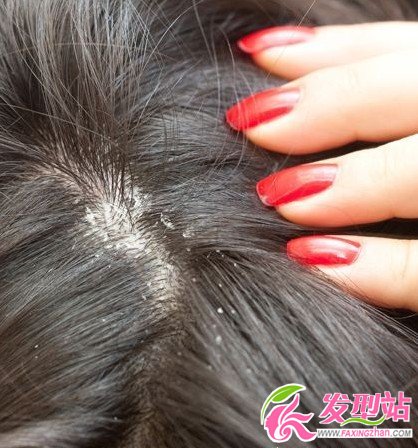 每次洗頭如何護(hù)理你的頭皮與秀發(fā)