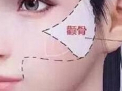 EǸmʲôl(f) EŮl(f)ͽ