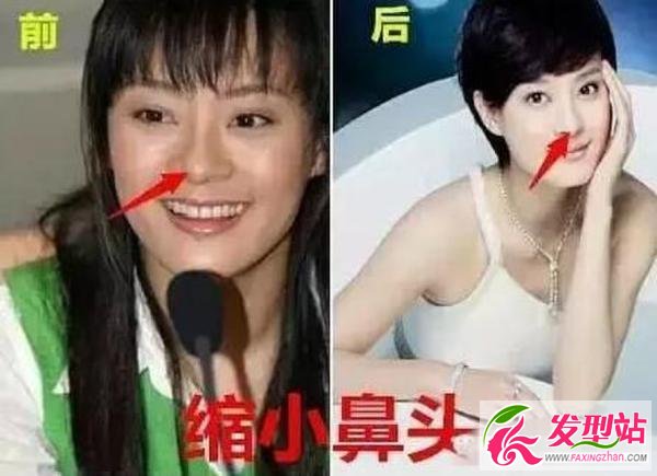 孫儷自爆整過容