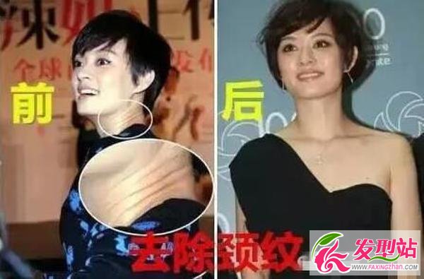 孫儷自爆整過容