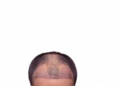 oֲl(f)挍Чc˲Ӱ푽x