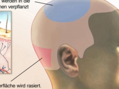 l(f)ֲl(f)ļҺc Ҏ(gu)ֲl(f)C(gu)]