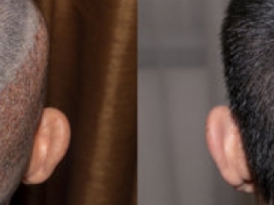 ľ΢ֲl(f)g(sh)t(y)Ժ] ľֲl(f)c(din)t(y)Ժ