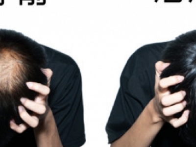 ־߅ίÓl(f)Чõt(y)Ժǰ ֿÓl(f)ļҏ(qing)