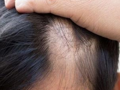 ֲl(f)g(sh)ˮ[̎ ֲl(f)ˮ[(yng)(du)