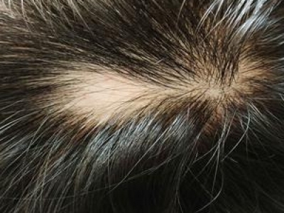 ֲl(f)ĹÆ Щ˿ֲl(f) mֲl(f)ķNȺ