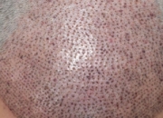 ֲl(f)^(q)t[ô ֲl(f)g(sh)t[̎