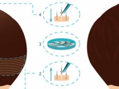 ľֲl(f)g(sh)õt(y)Ժ] ֲl(f)t(y)ԺTOP1